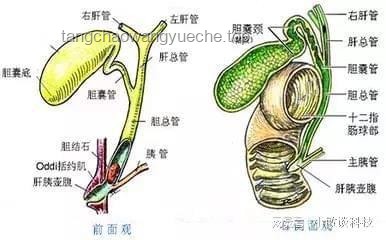 **长期夜班与胆囊结石风险：一女子10年夜班生活与95颗结石的警示**